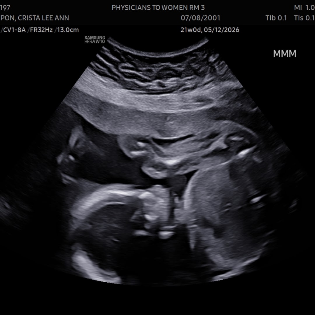 Photo shared by Crista for their Babylist baby registry.