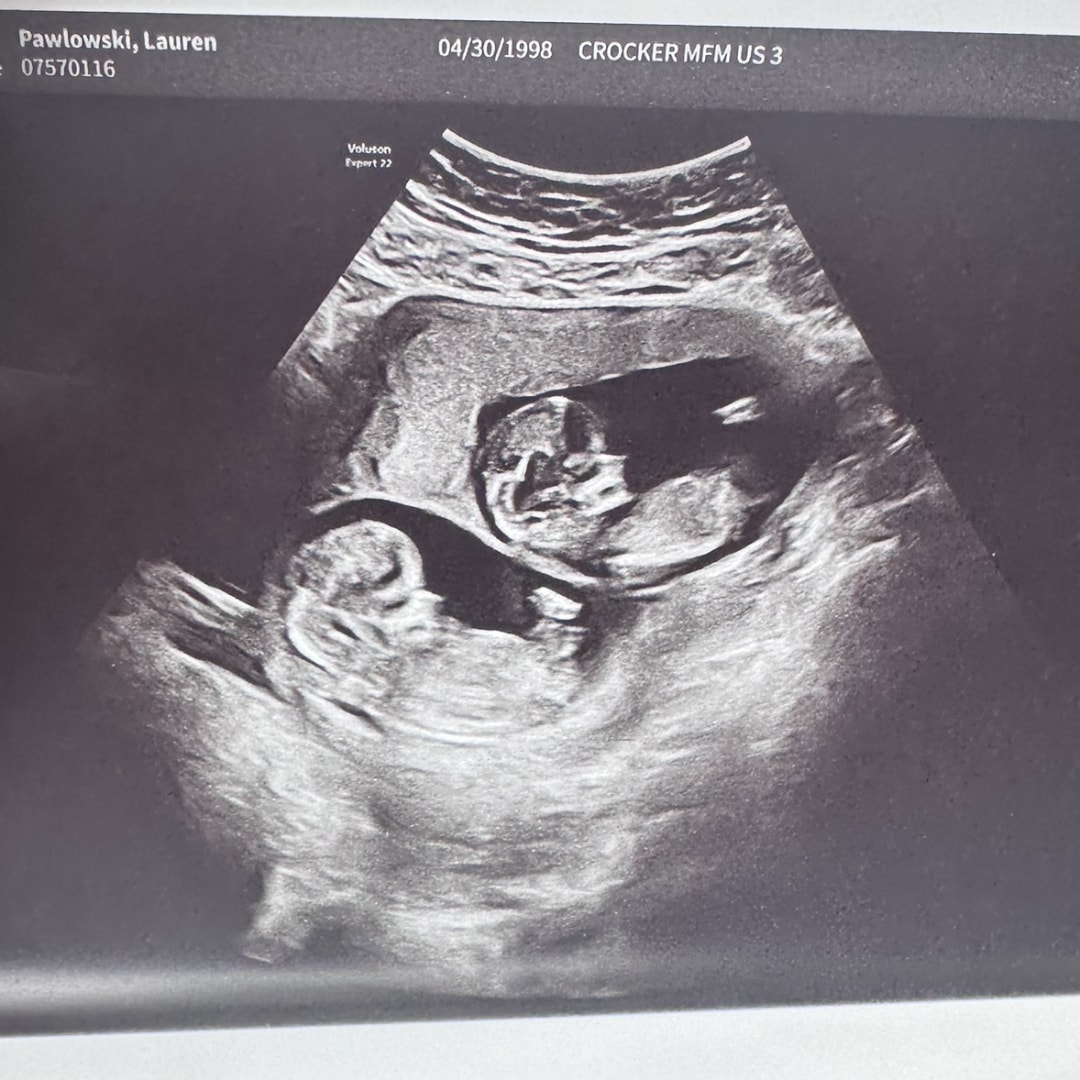 Photo shared by Lauren for their Babylist baby registry.
