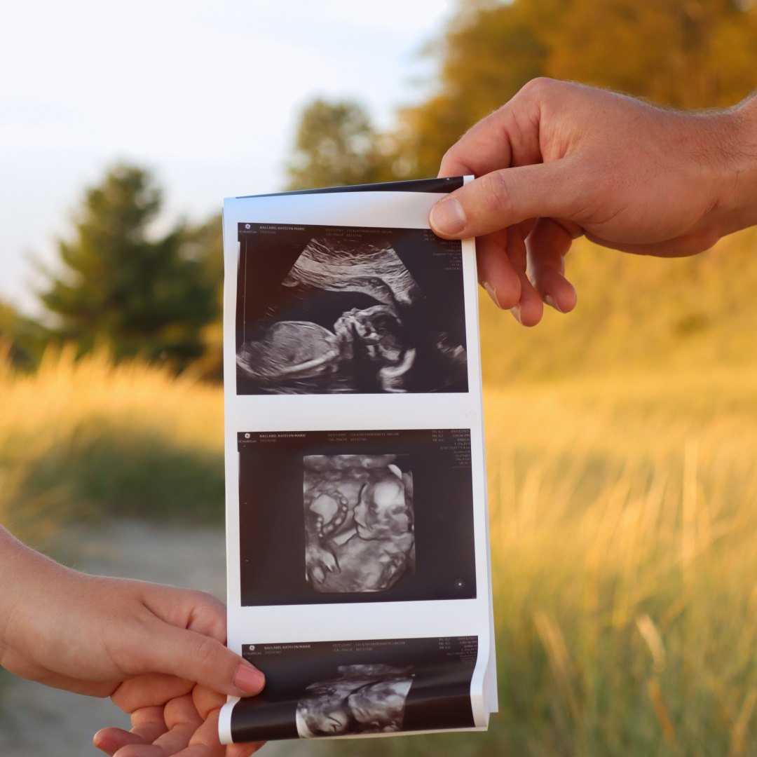 Photo shared by Katie for their Babylist baby registry.