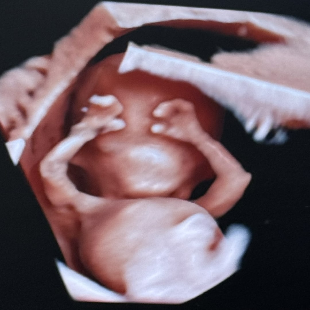 Photo shared by Victoria for their Babylist baby registry.