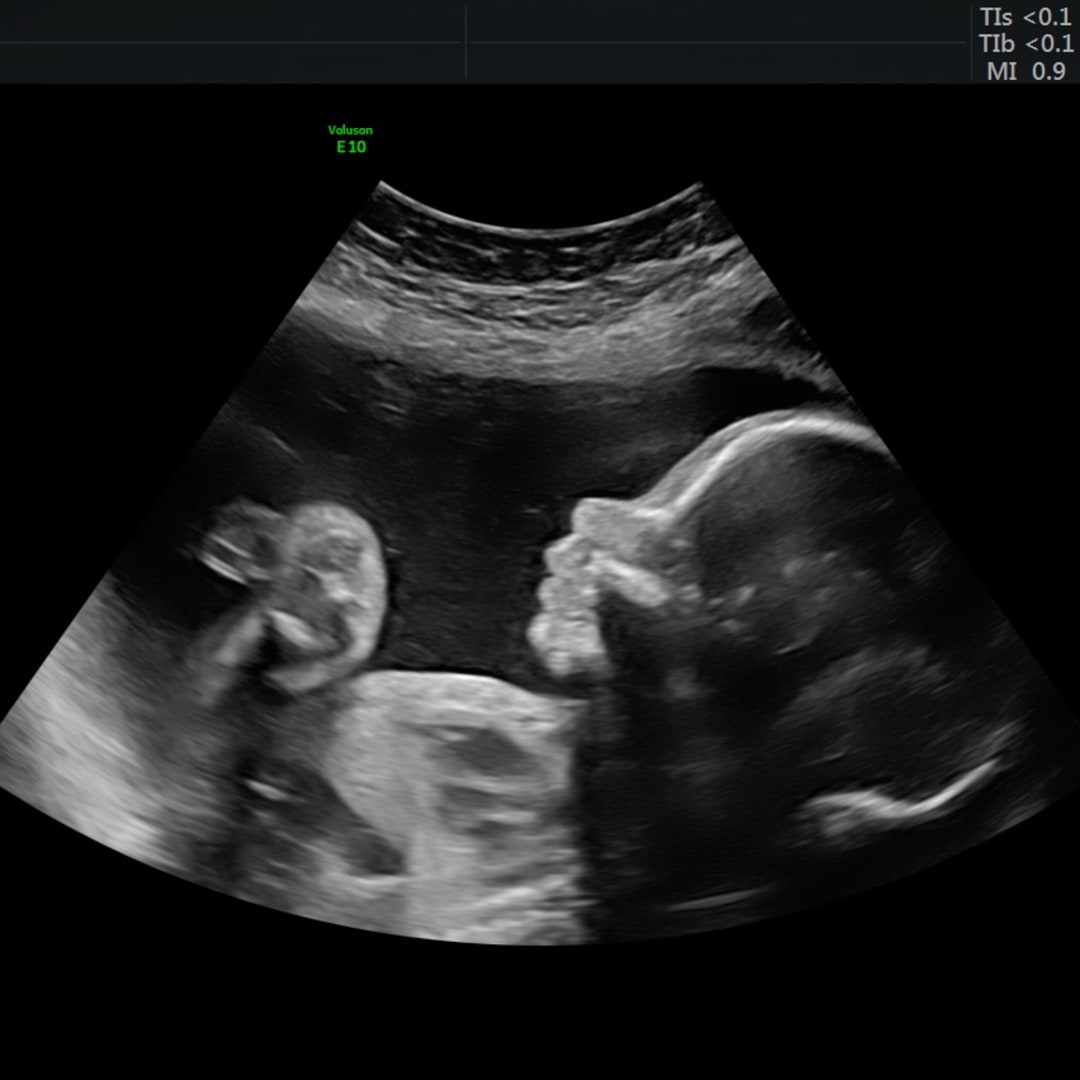 Photo shared by Jade for their Babylist baby registry.