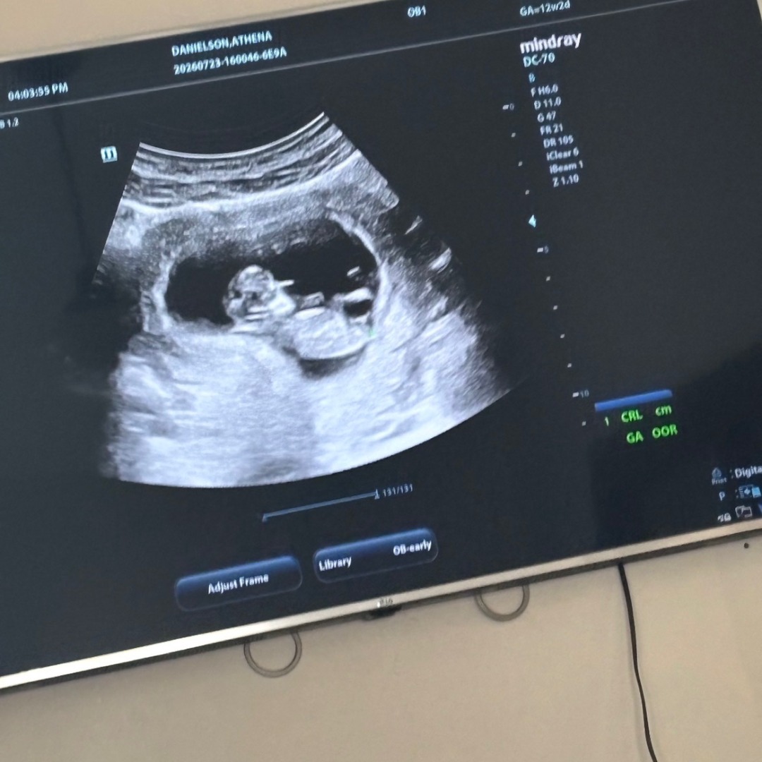 Photo shared by Athena for their Babylist baby registry.