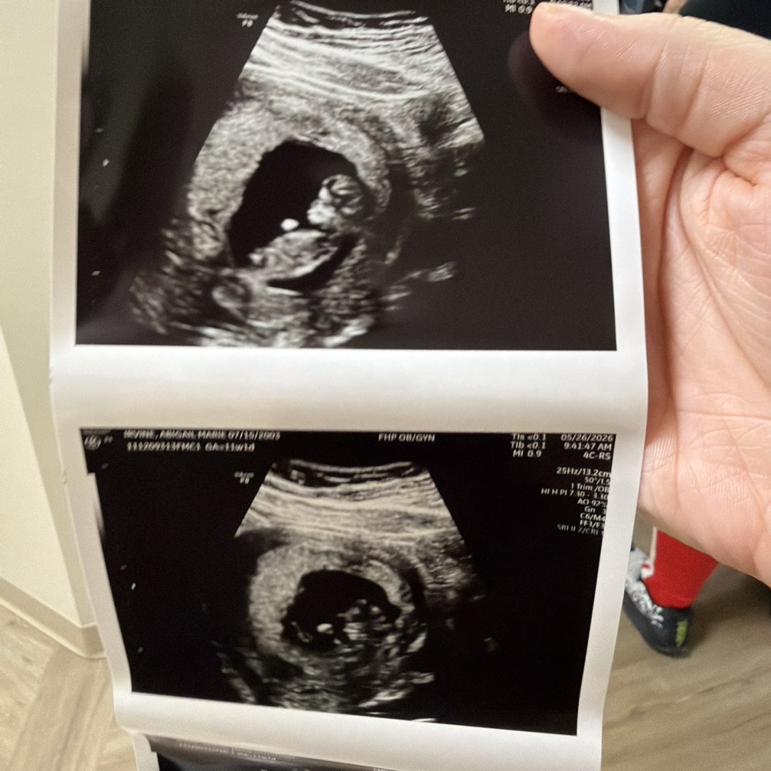 Photo shared by Abby for their Babylist baby registry.