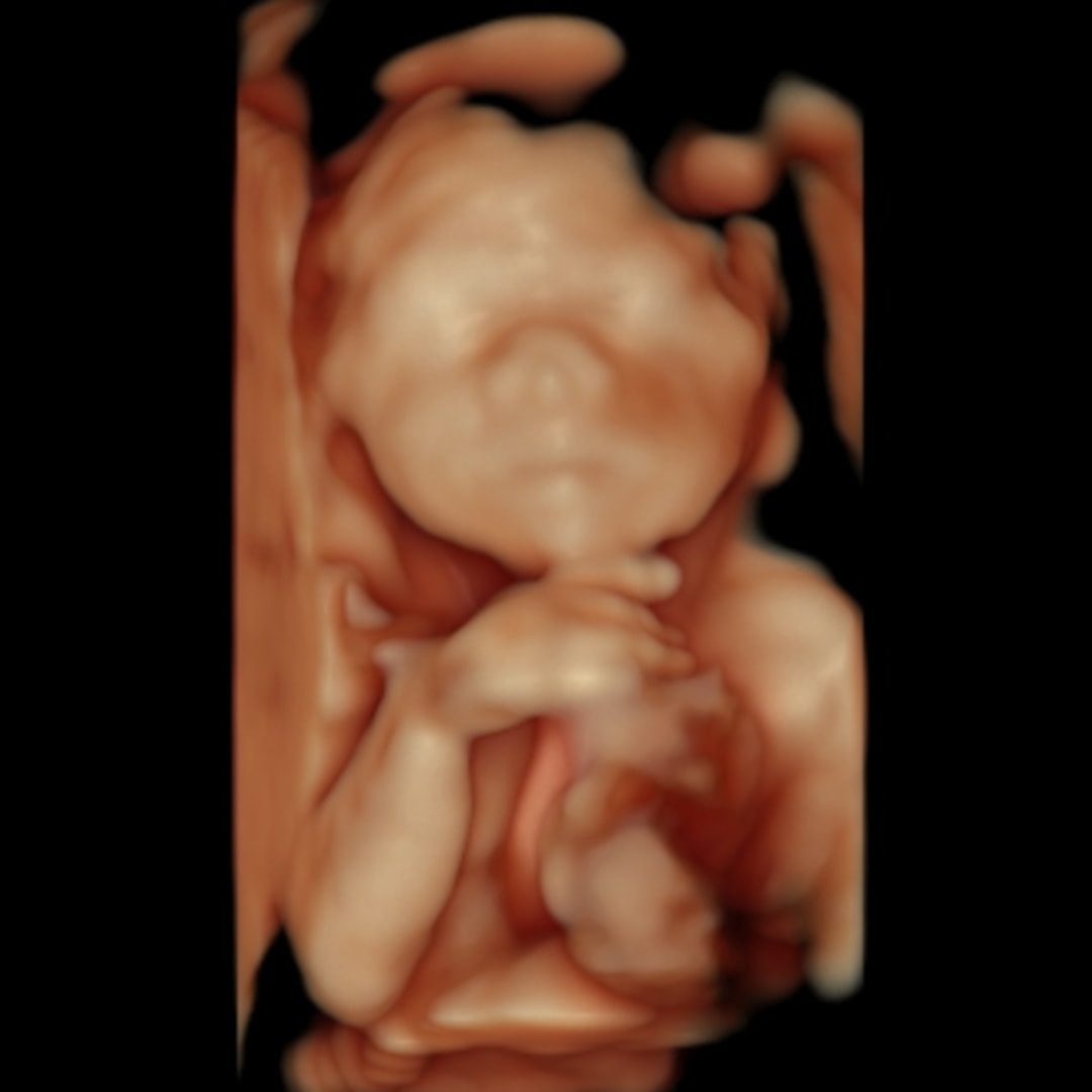 Photo shared by Susan for their Babylist baby registry.