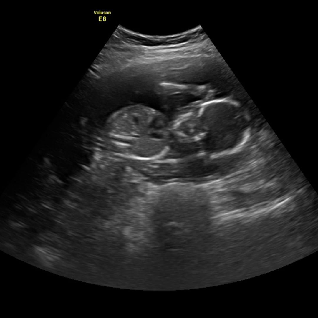 Photo shared by Hunter for their Babylist baby registry.