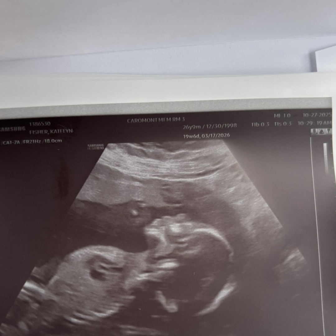 Photo shared by Katelyn for their Babylist baby registry.