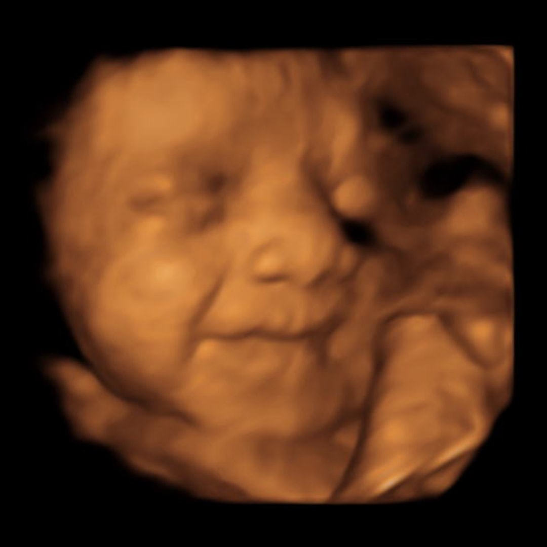 Photo shared by Jordyn for their Babylist baby registry.
