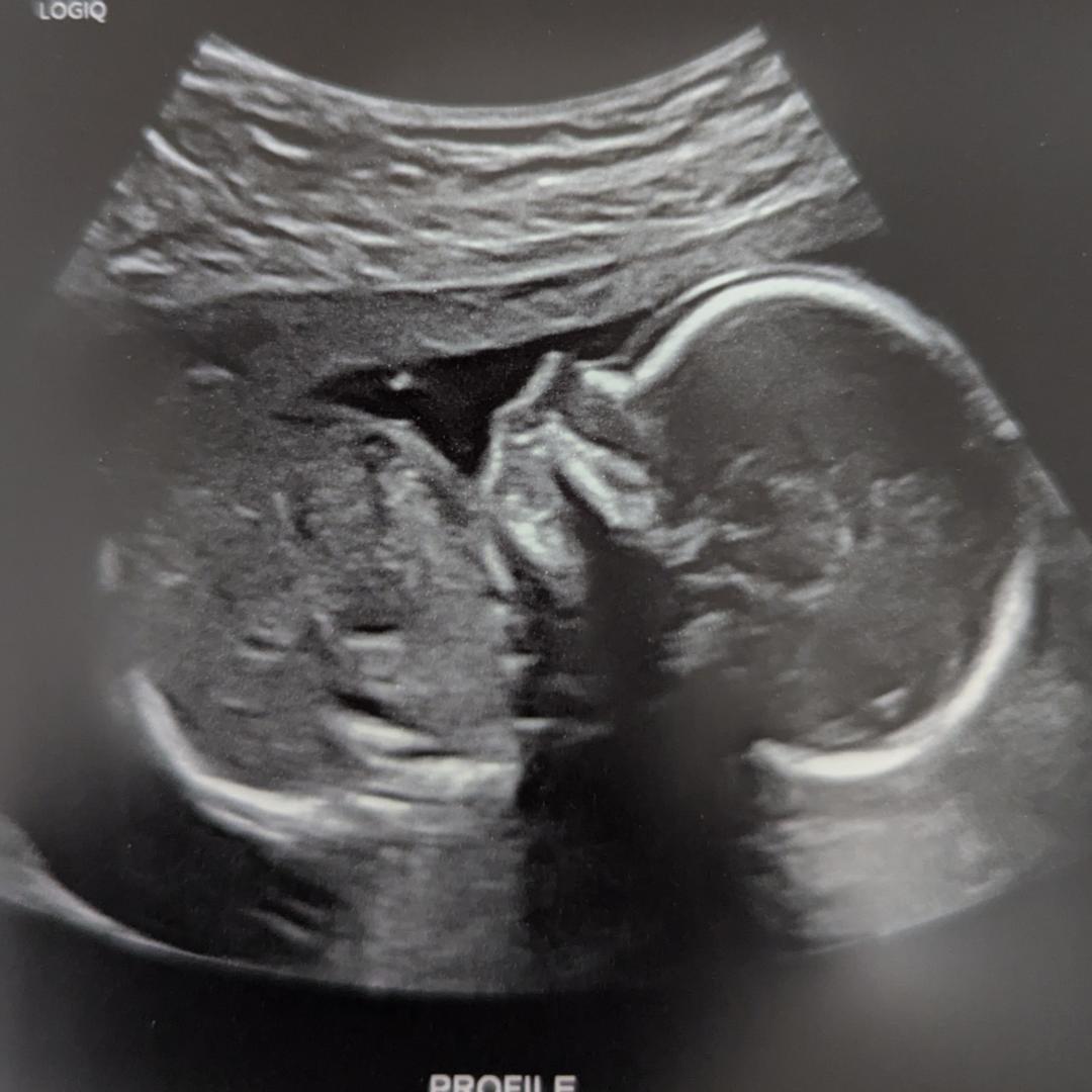 Photo shared by McKenna for their Babylist baby registry.