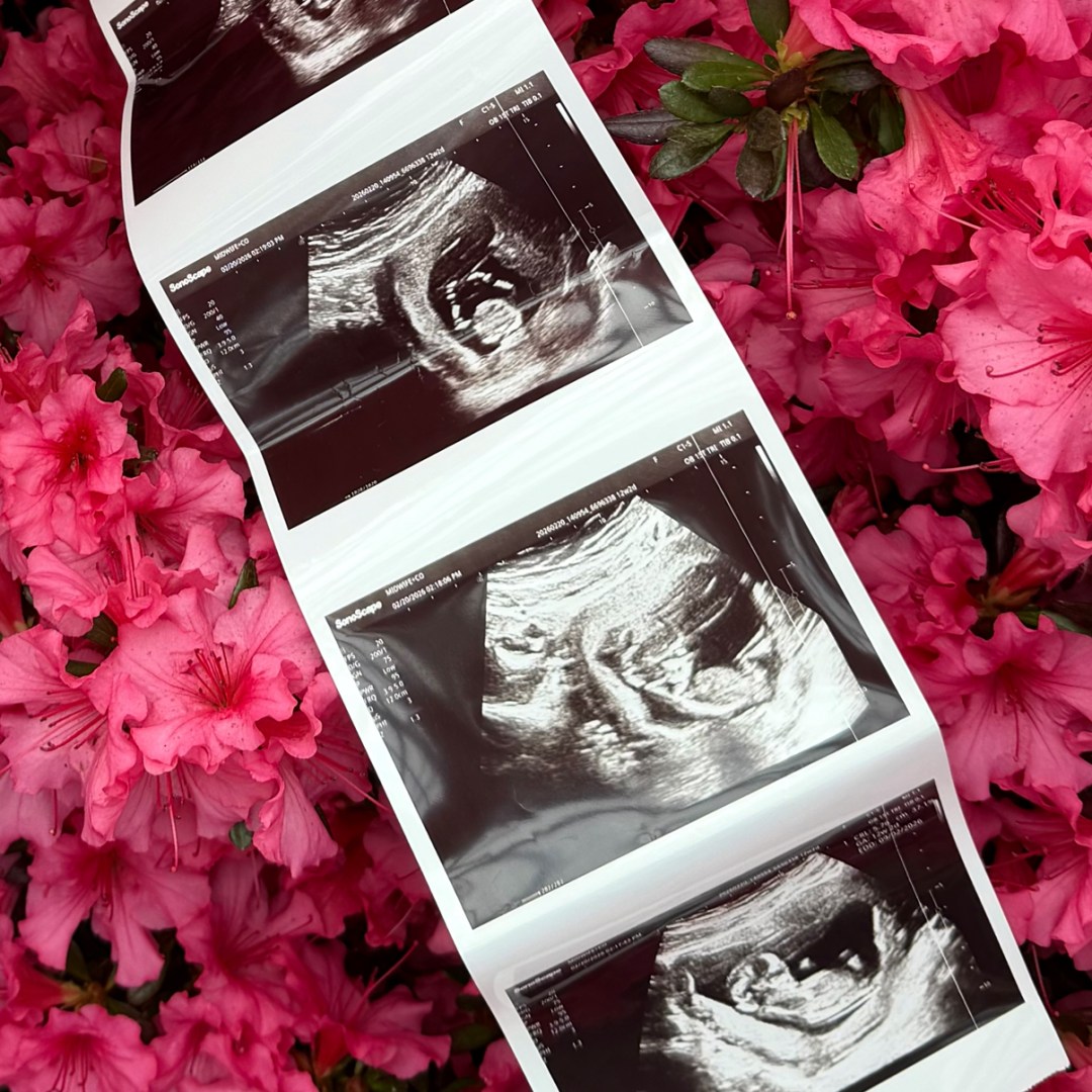 Photo shared by Madeline for their Babylist baby registry.