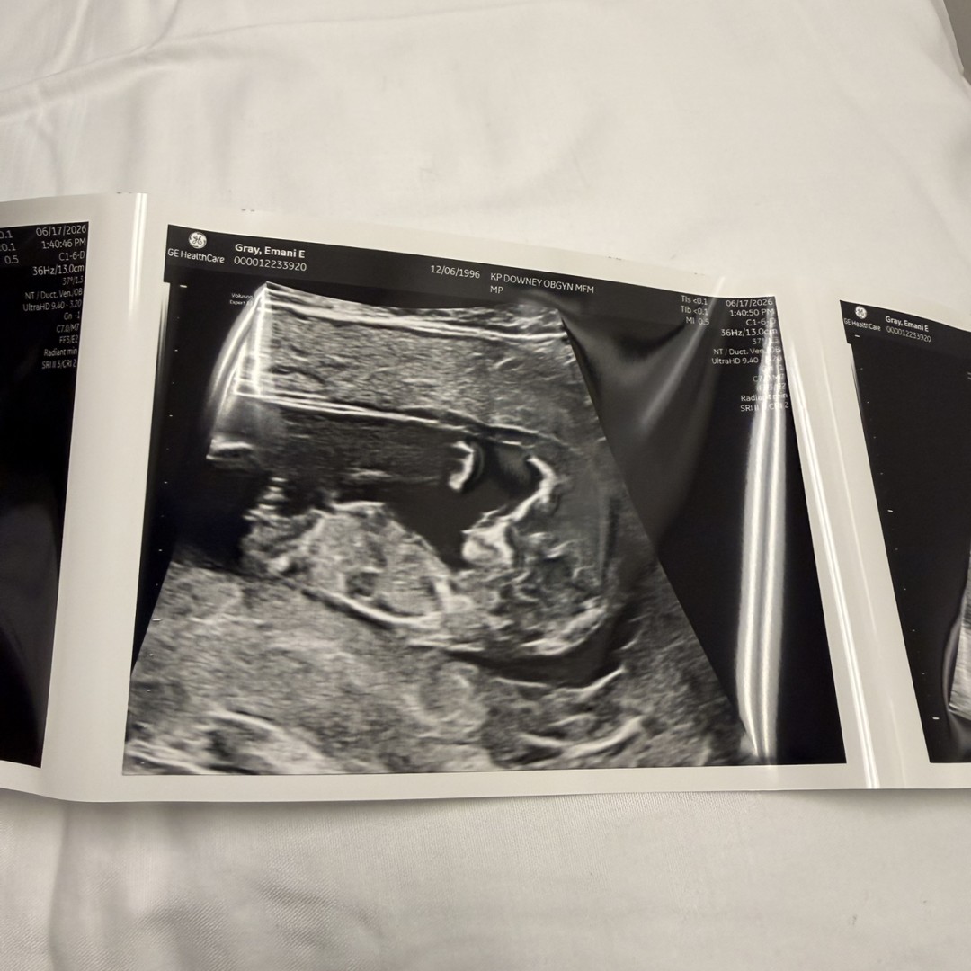 Photo shared by DeAngelo for their Babylist baby registry.