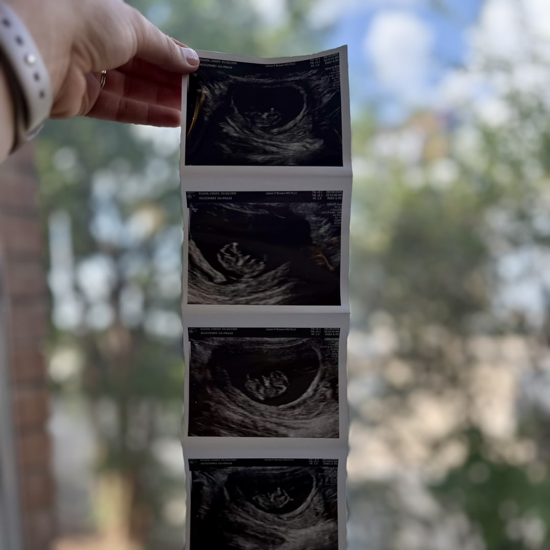 Photo shared by Lynzee for their Babylist baby registry.