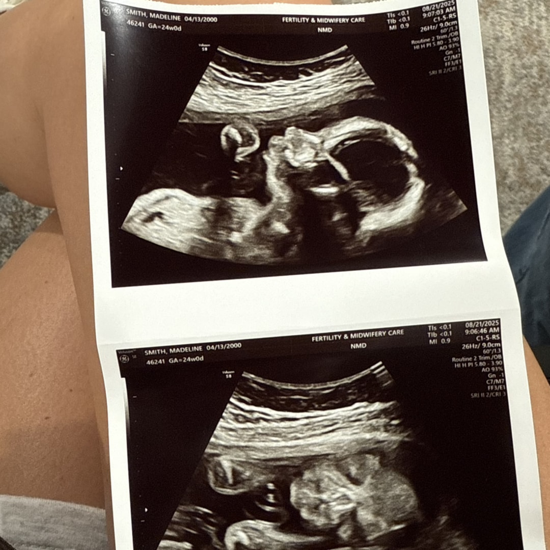 Photo shared by Madeline for their Babylist baby registry.