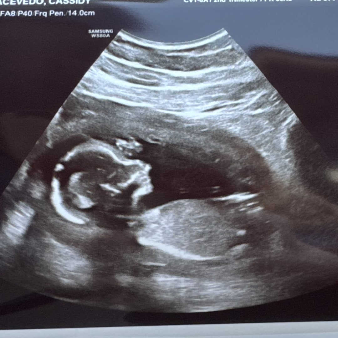 Photo shared by Cassidy for their Babylist baby registry.