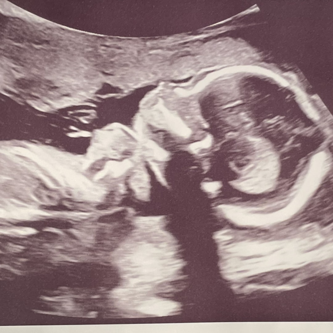 Photo shared by Leslie for their Babylist baby registry.