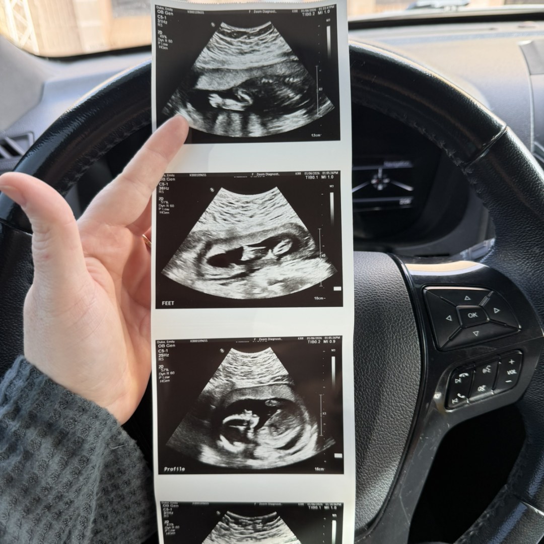 Photo shared by Emily for their Babylist baby registry.