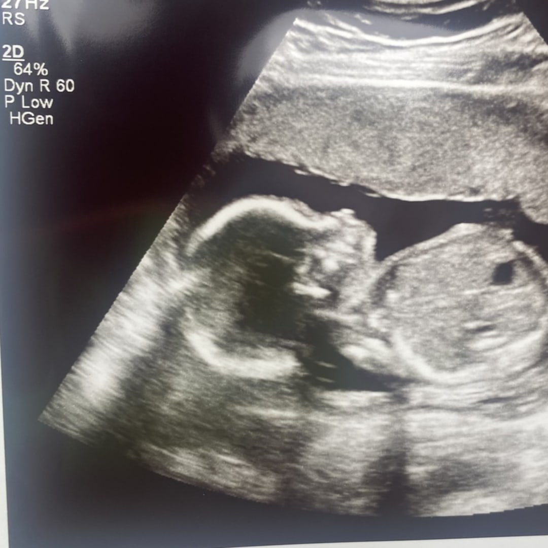 Photo shared by Olivia for their Babylist baby registry.