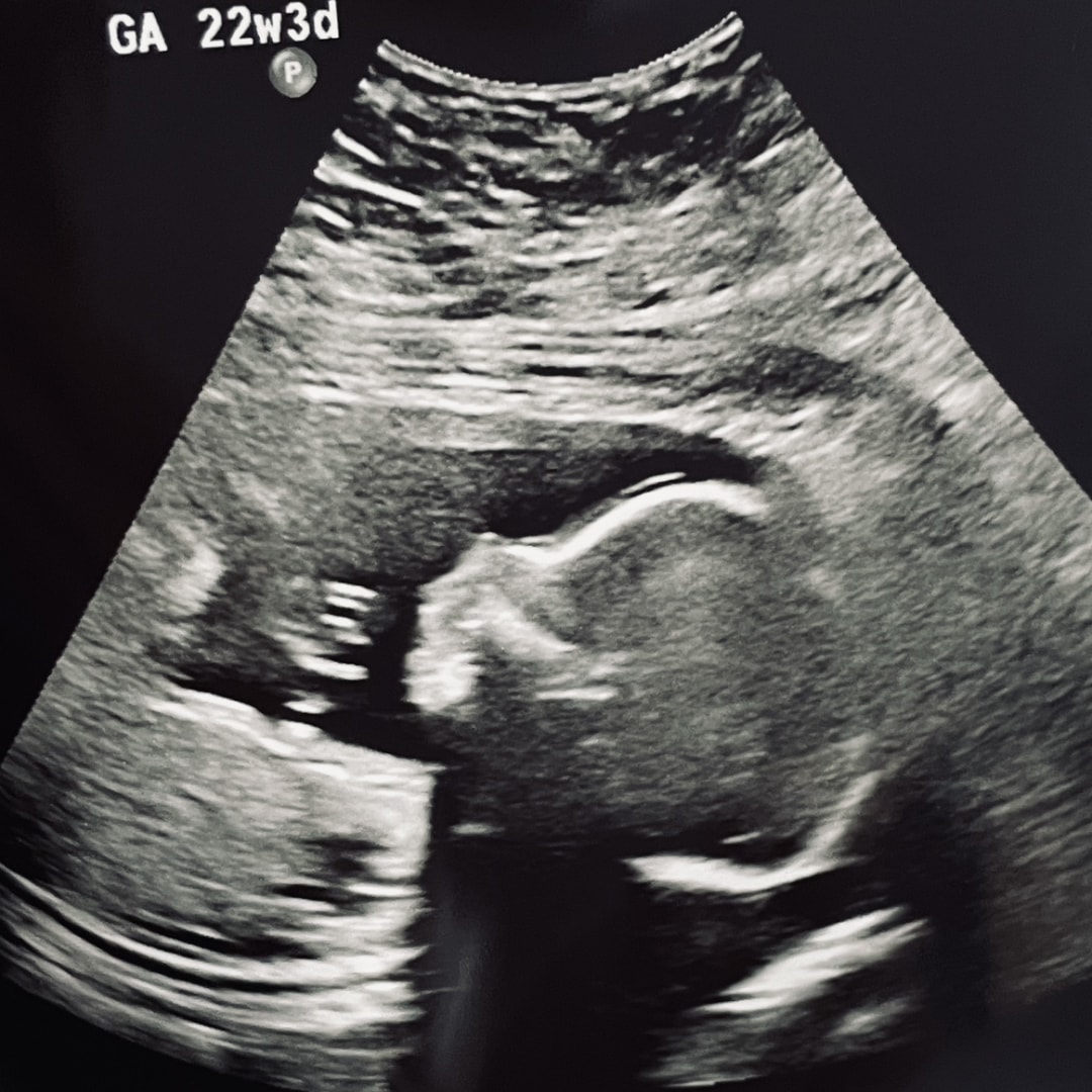 Photo shared by Dessiree for their Babylist baby registry.