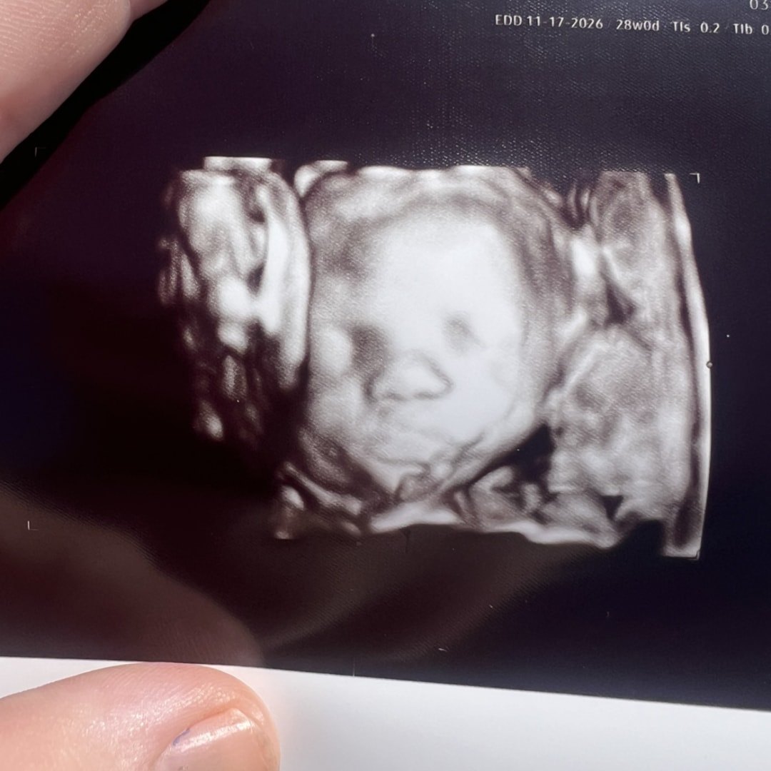 Photo shared by Kaitlin for their Babylist baby registry.