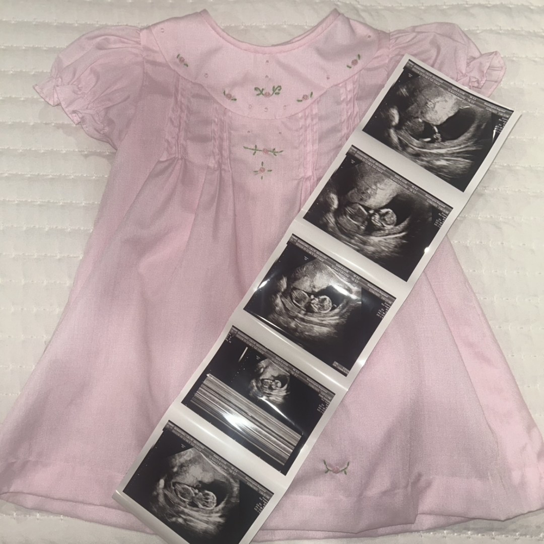 Photo shared by Callye for their Babylist baby registry.