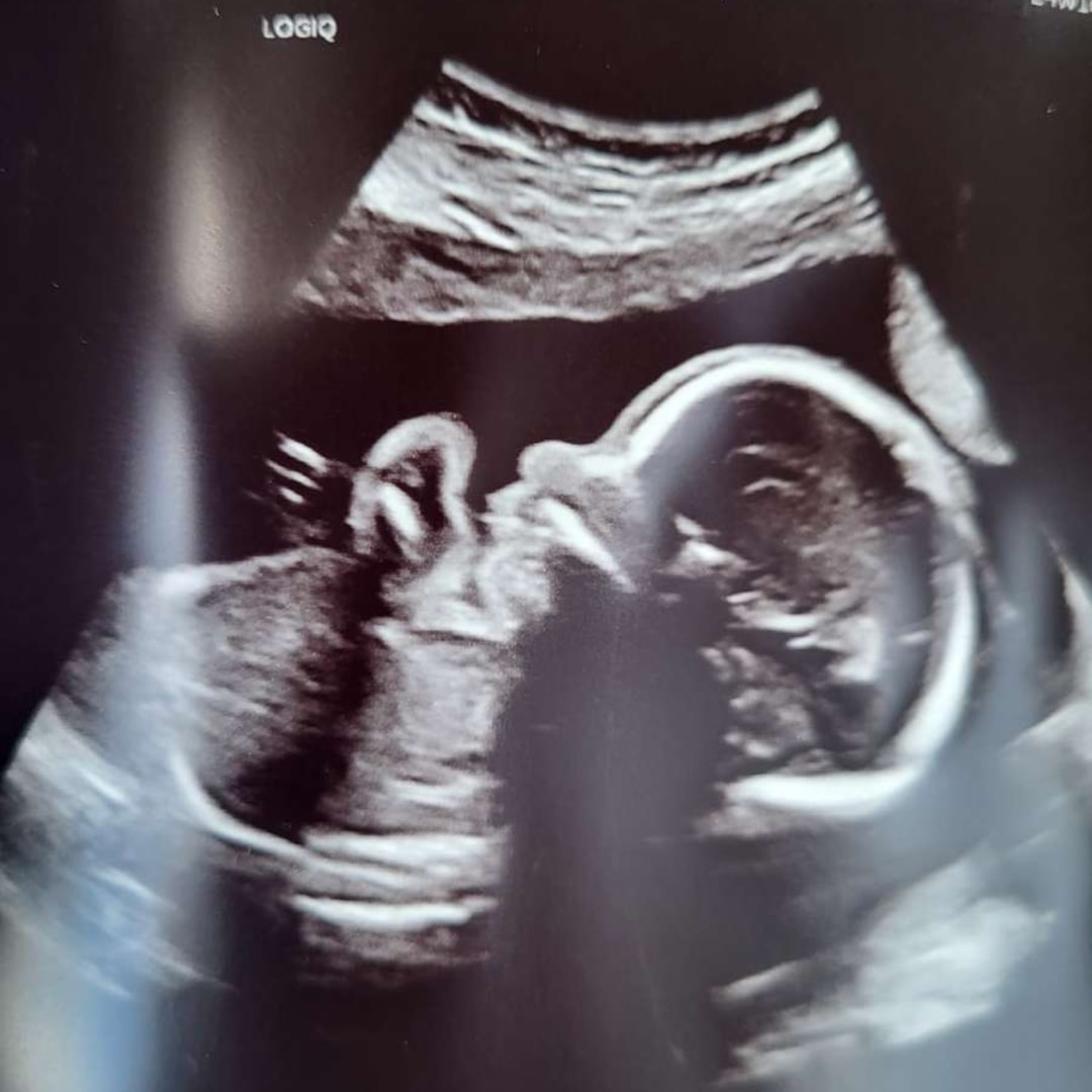 Photo shared by Andrea for their Babylist baby registry.
