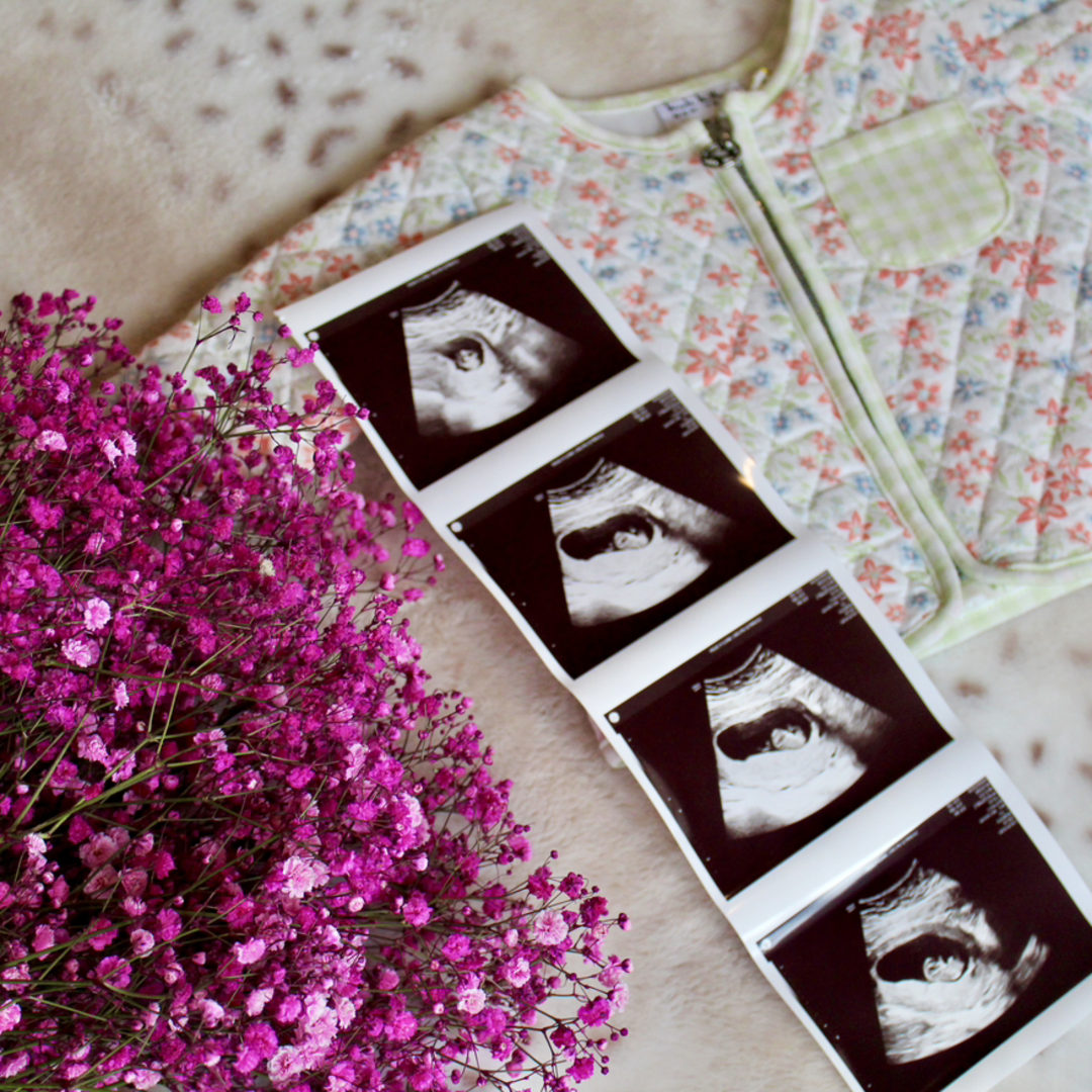 Photo shared by Carrie for their Babylist baby registry.