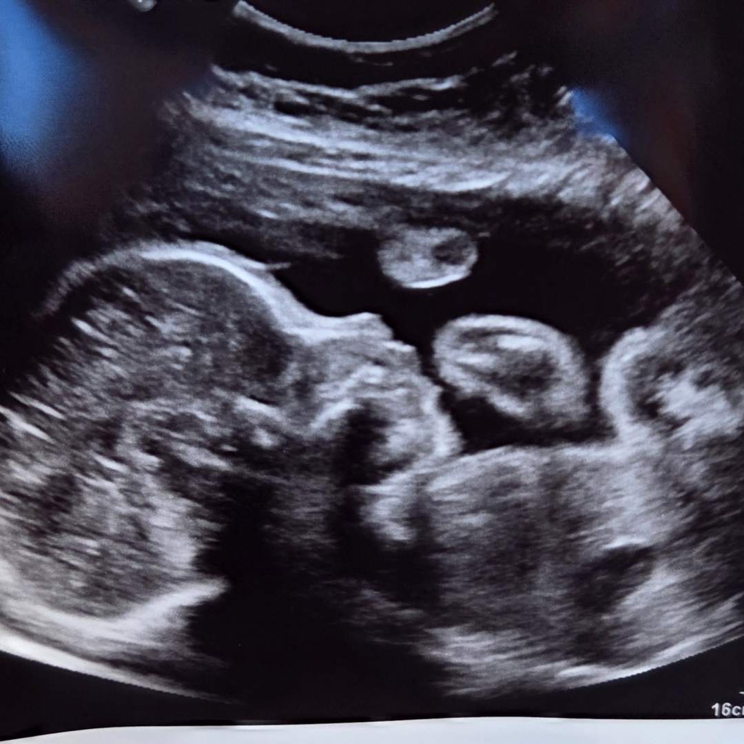 Photo shared by Joslyn for their Babylist baby registry.