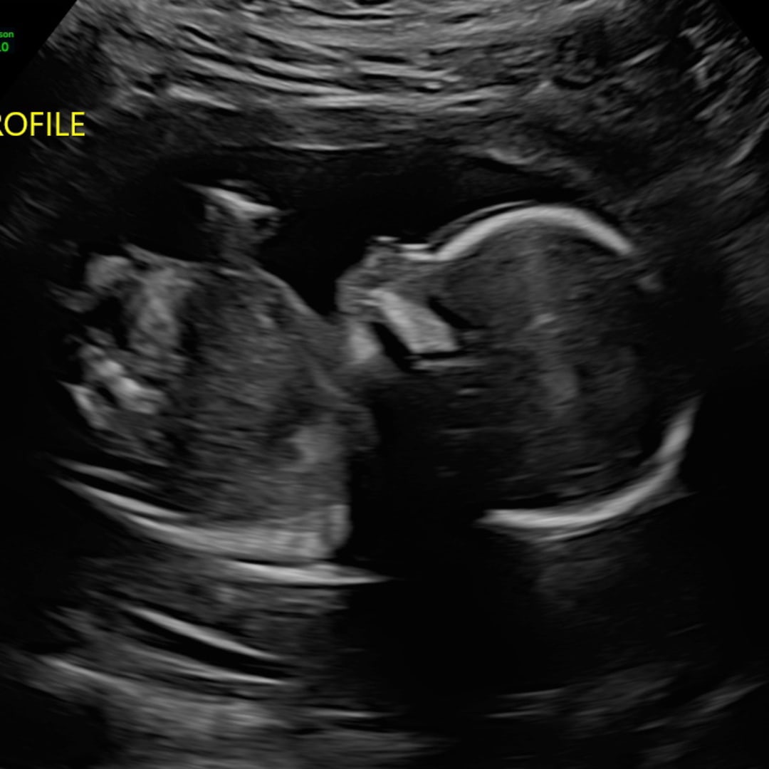 Photo shared by Ariana for their Babylist baby registry.