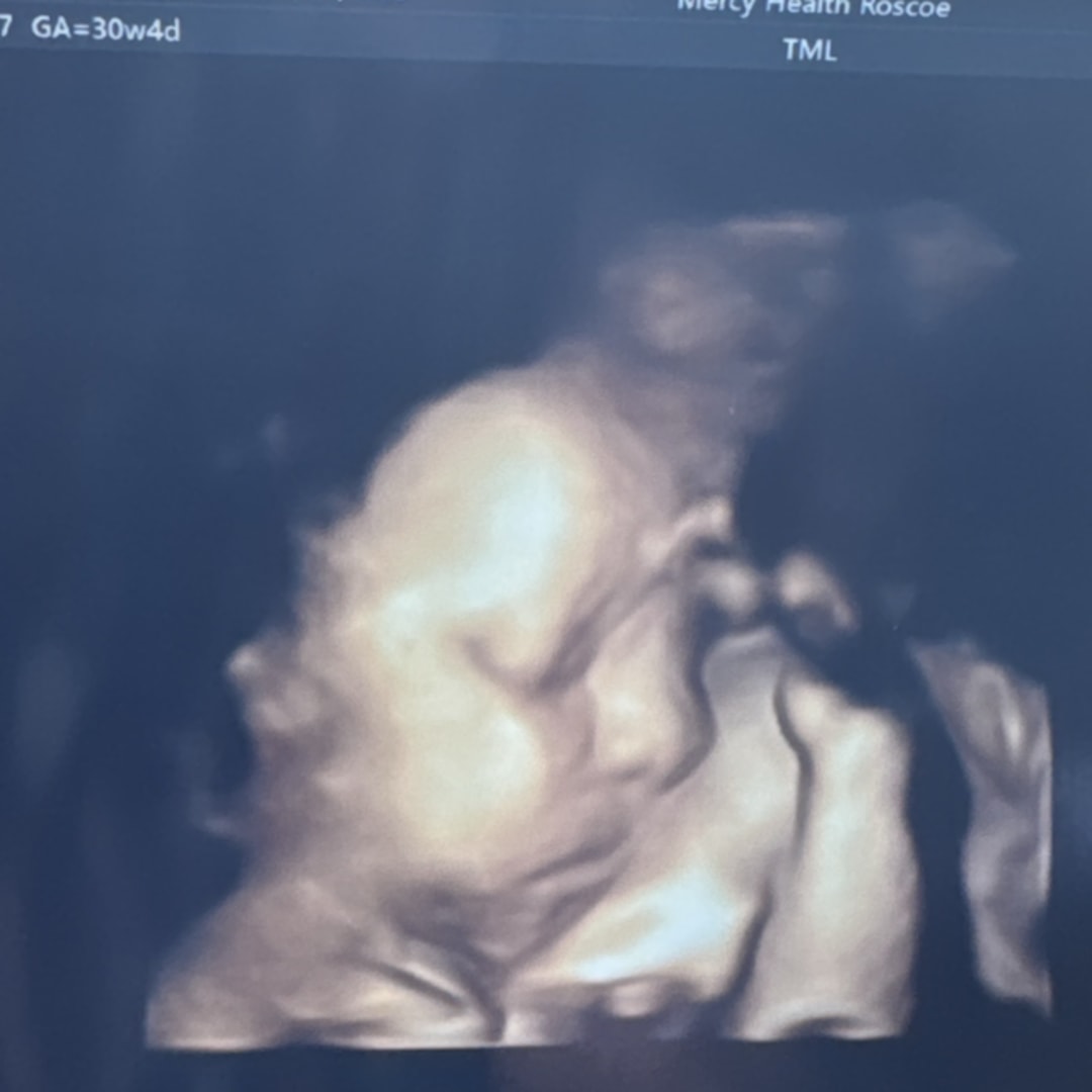 Photo shared by Rachel for their Babylist baby registry.