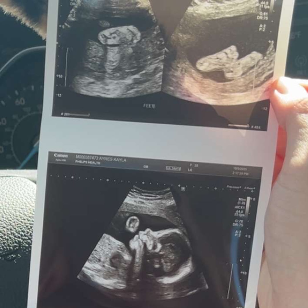 Photo shared by Kayla for their Babylist baby registry.