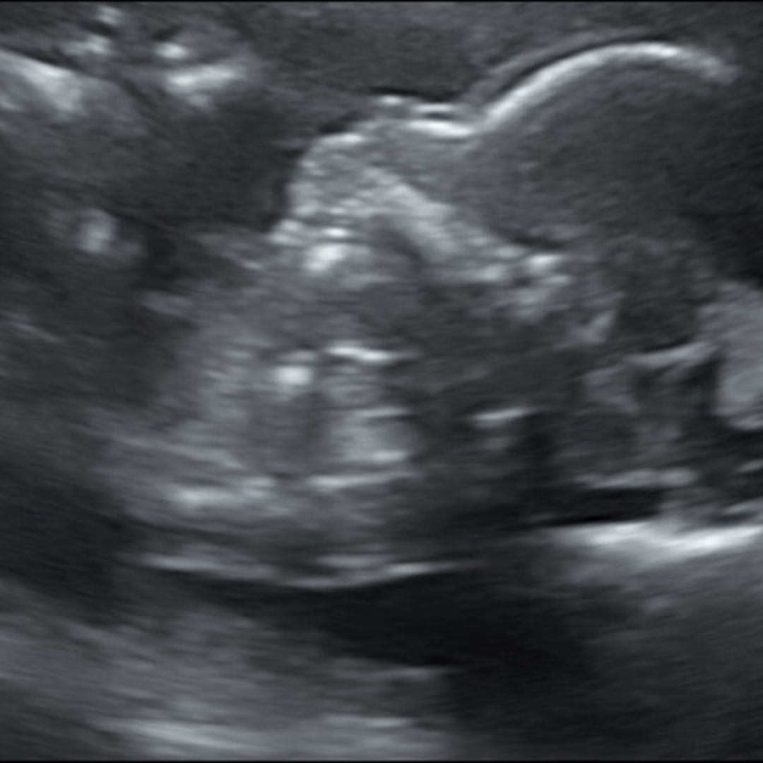 Photo shared by Ki for their Babylist baby registry.