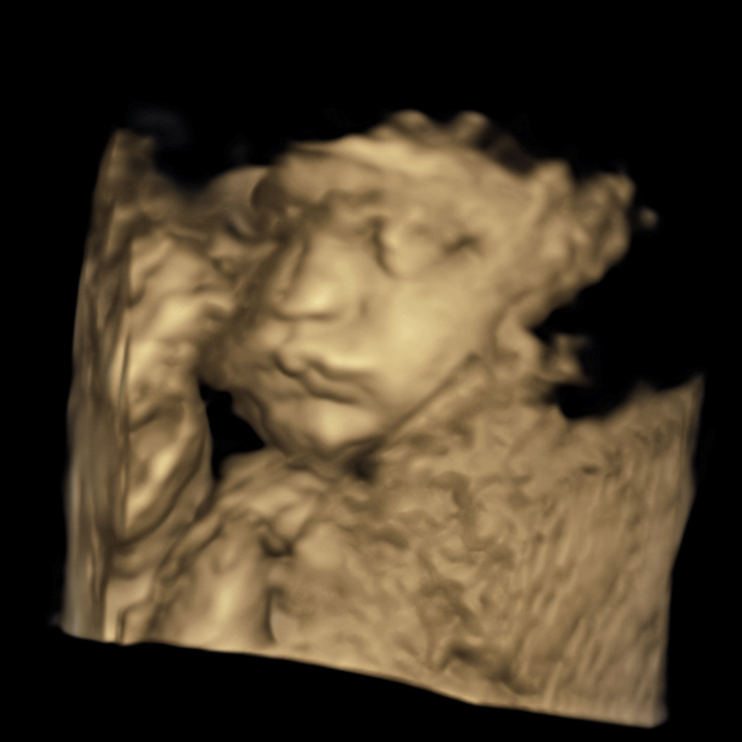 Photo shared by Sophia for their Babylist baby registry.