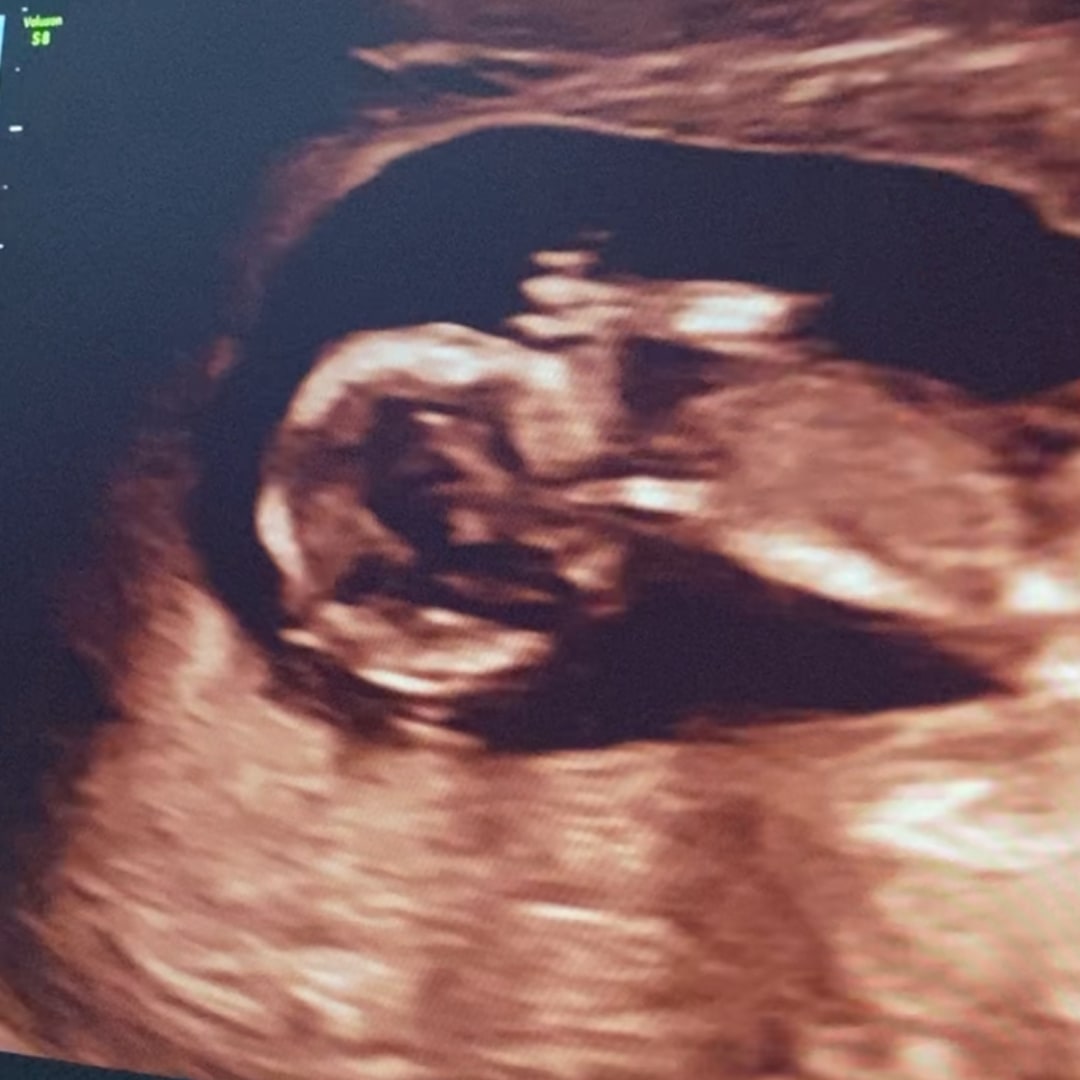 Photo shared by July for their Babylist baby registry.
