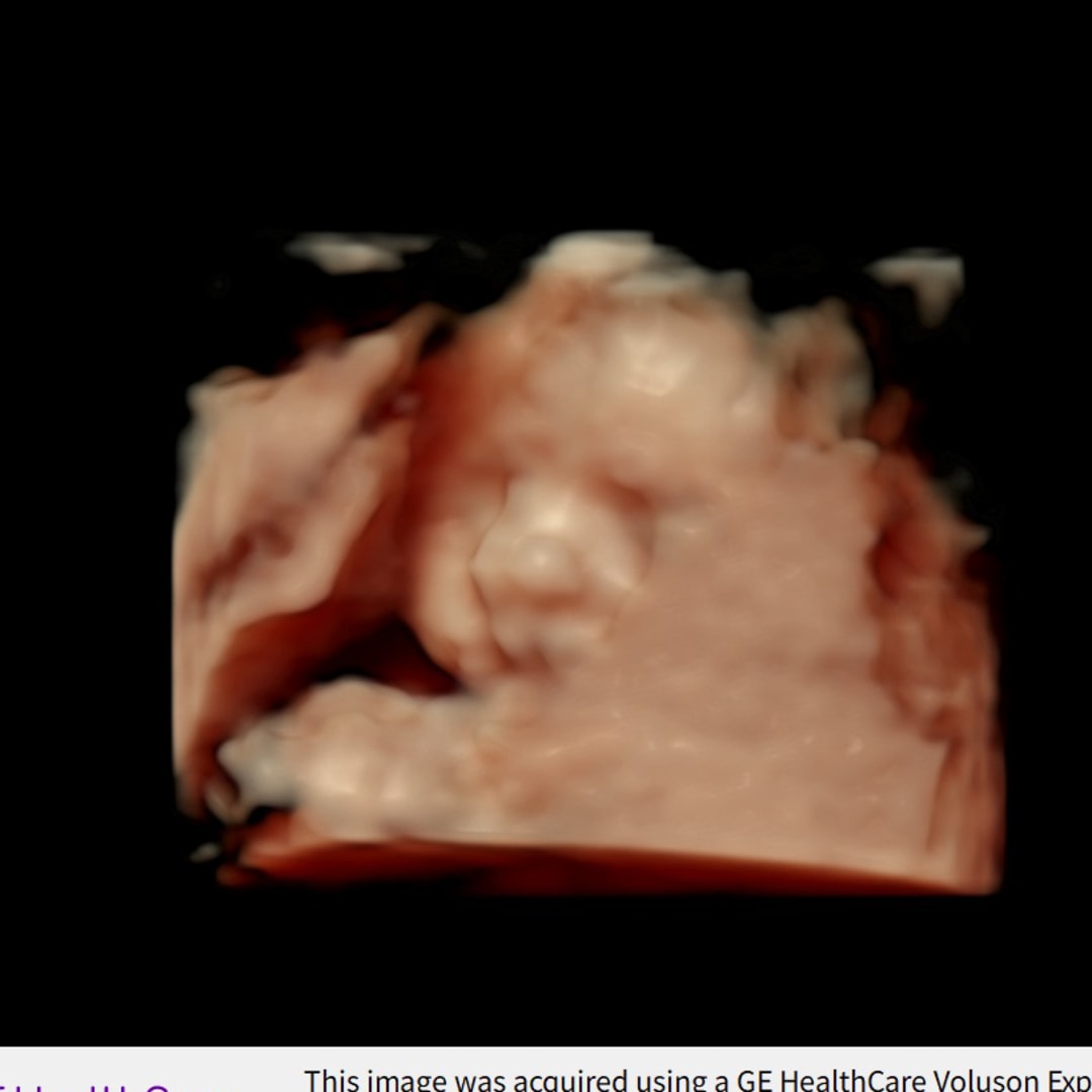 Photo shared by Katherine for their Babylist baby registry.