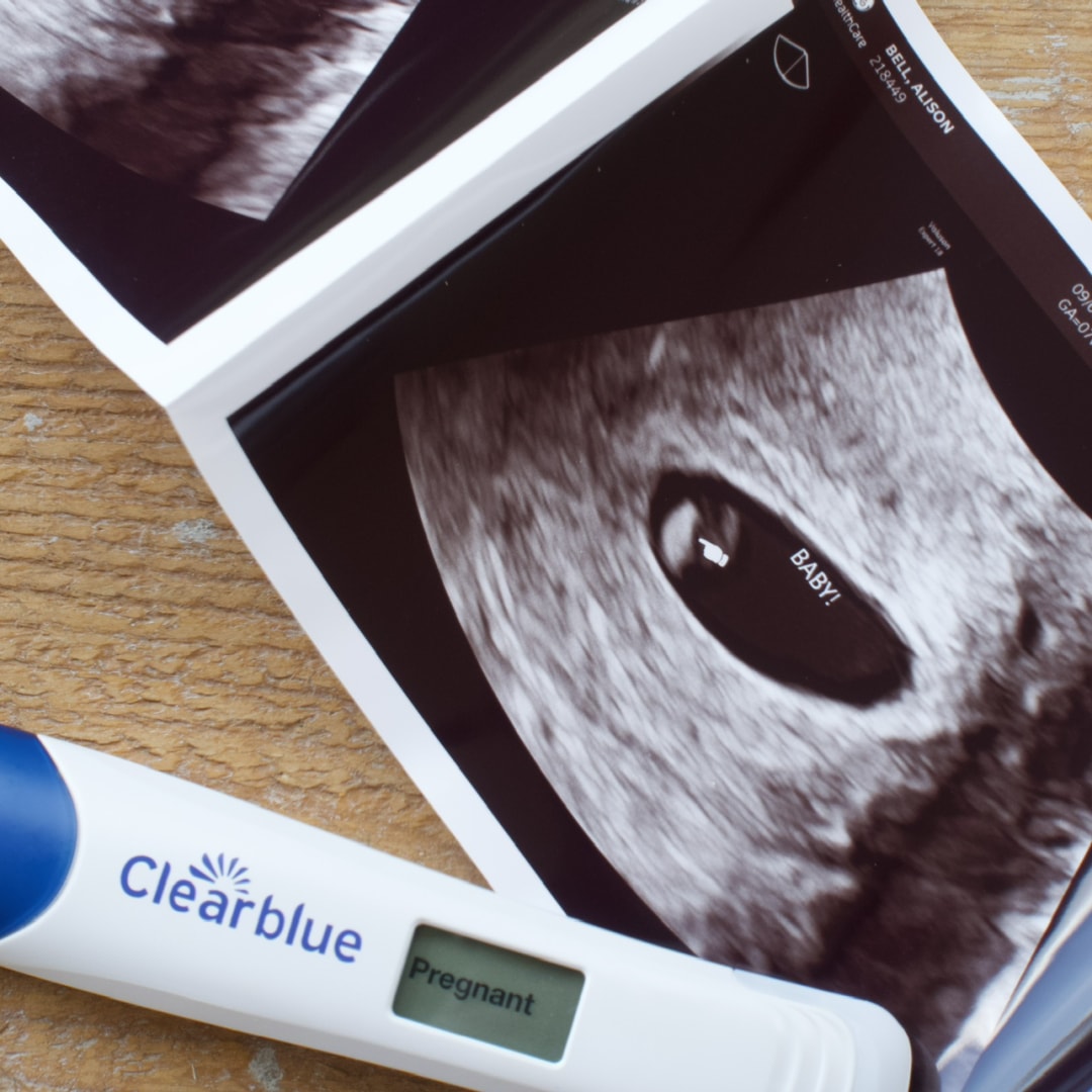 Photo shared by Alison for their Babylist baby registry.
