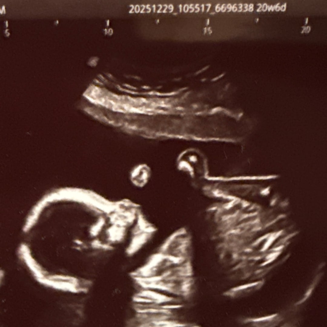 Photo shared by Mariah for their Babylist baby registry.