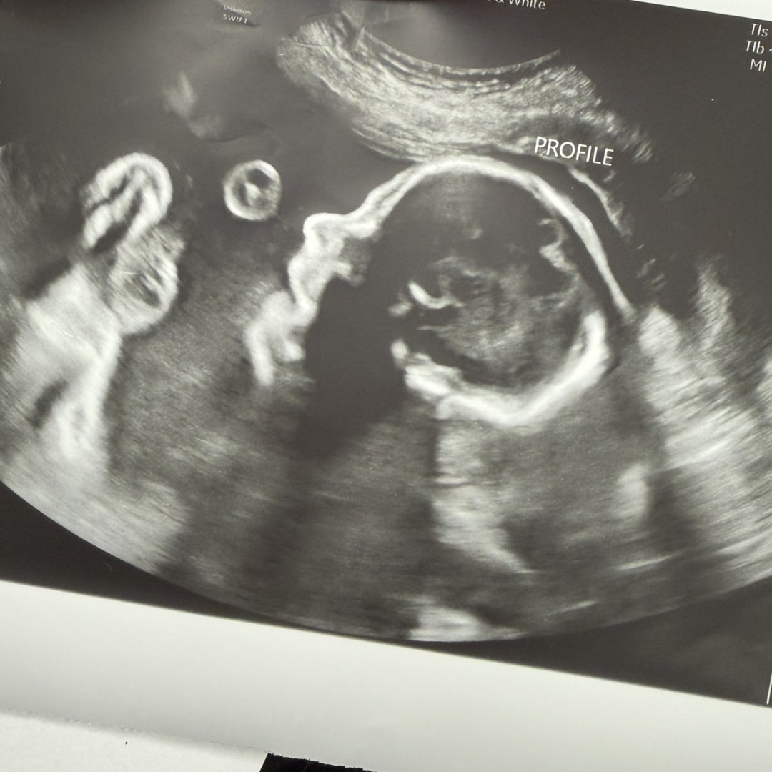 Photo shared by Alyssa for their Babylist baby registry.