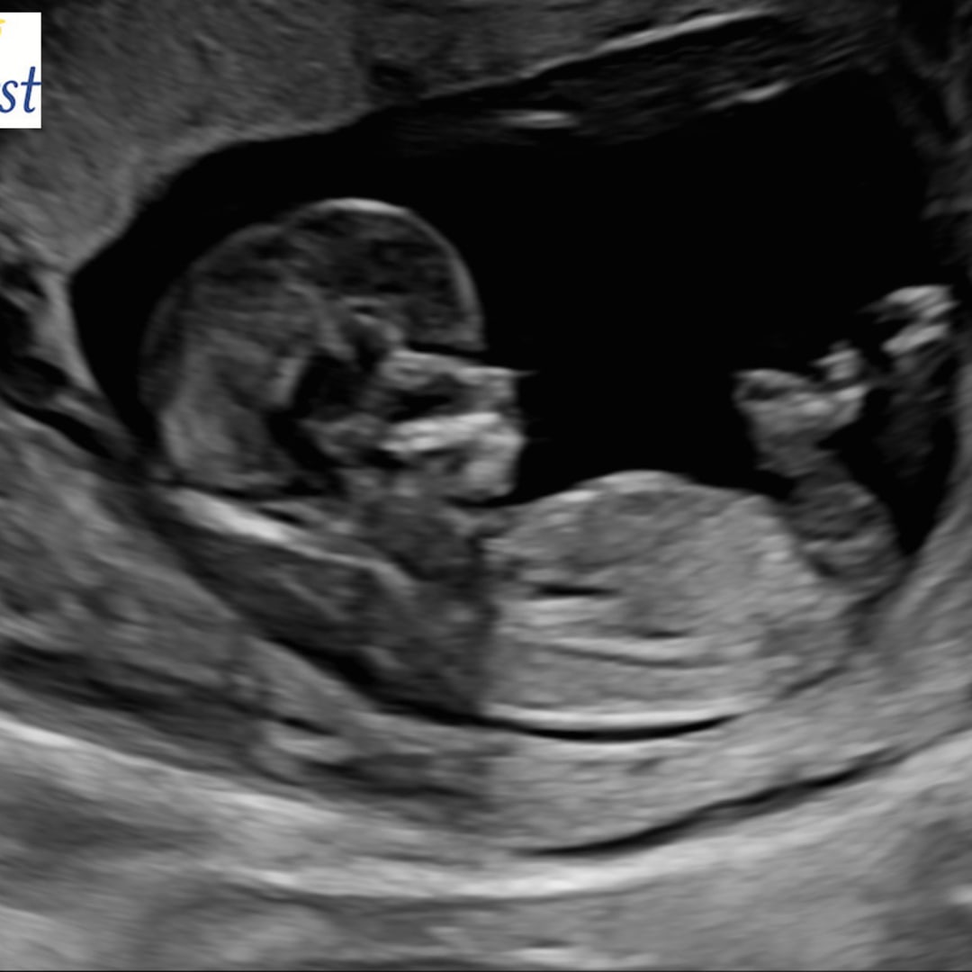 Photo shared by Anna for their Babylist baby registry.
