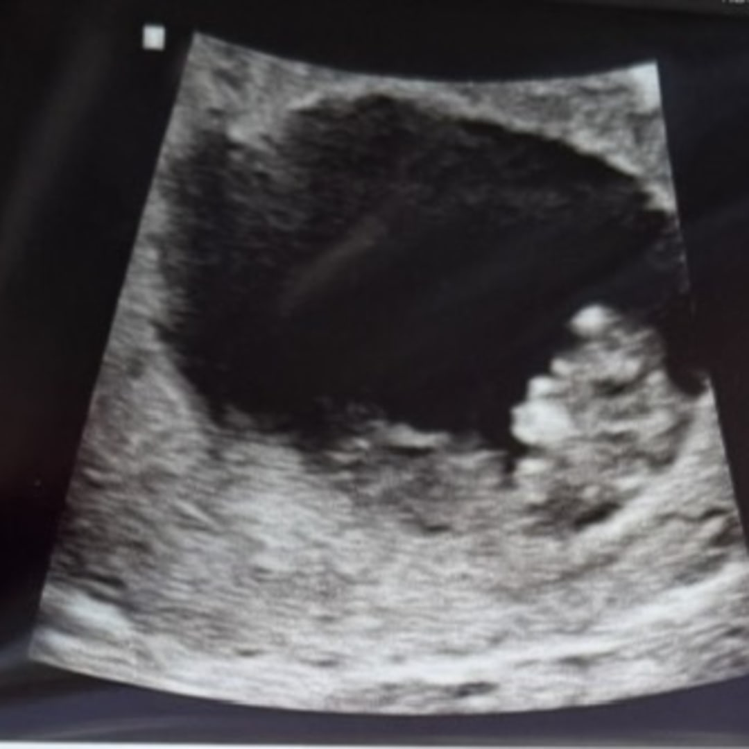 Photo shared by Bailee for their Babylist baby registry.