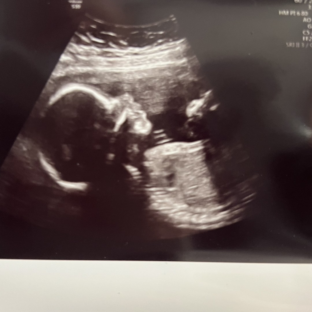 Photo shared by Megan for their Babylist baby registry.