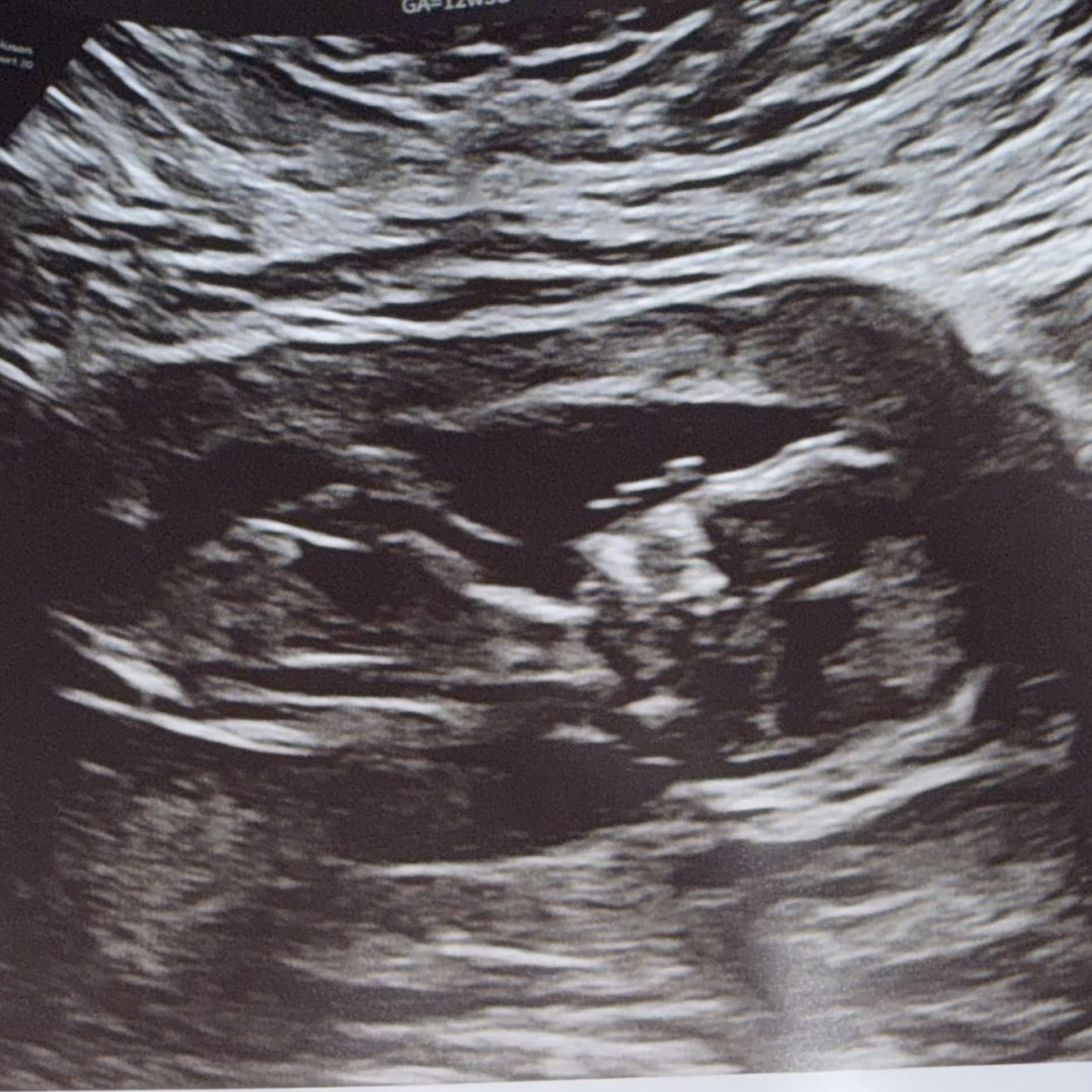 Photo shared by Audrey for their Babylist baby registry.