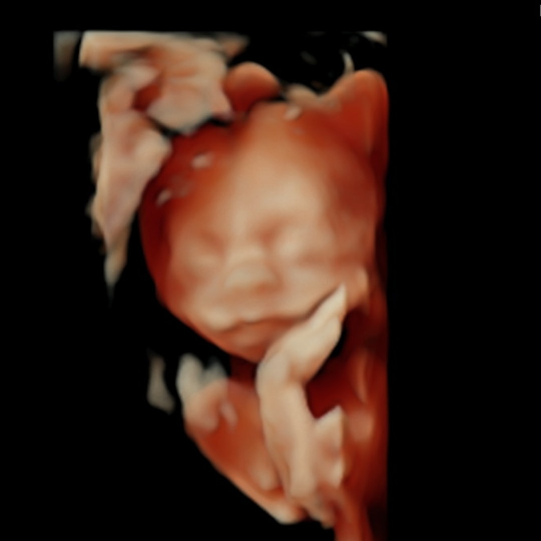 Photo shared by Rebecca for their Babylist baby registry.