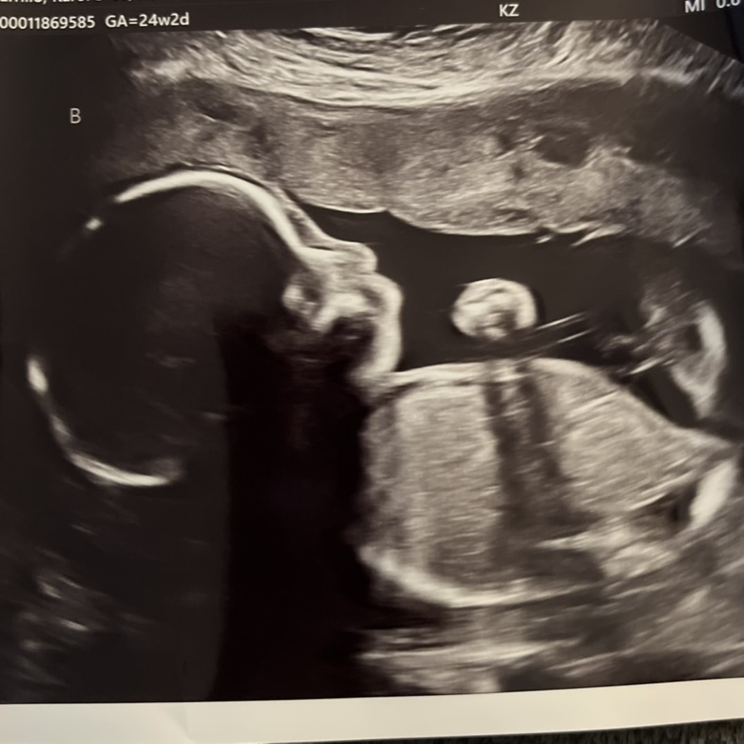 Photo shared by Karol for their Babylist baby registry.