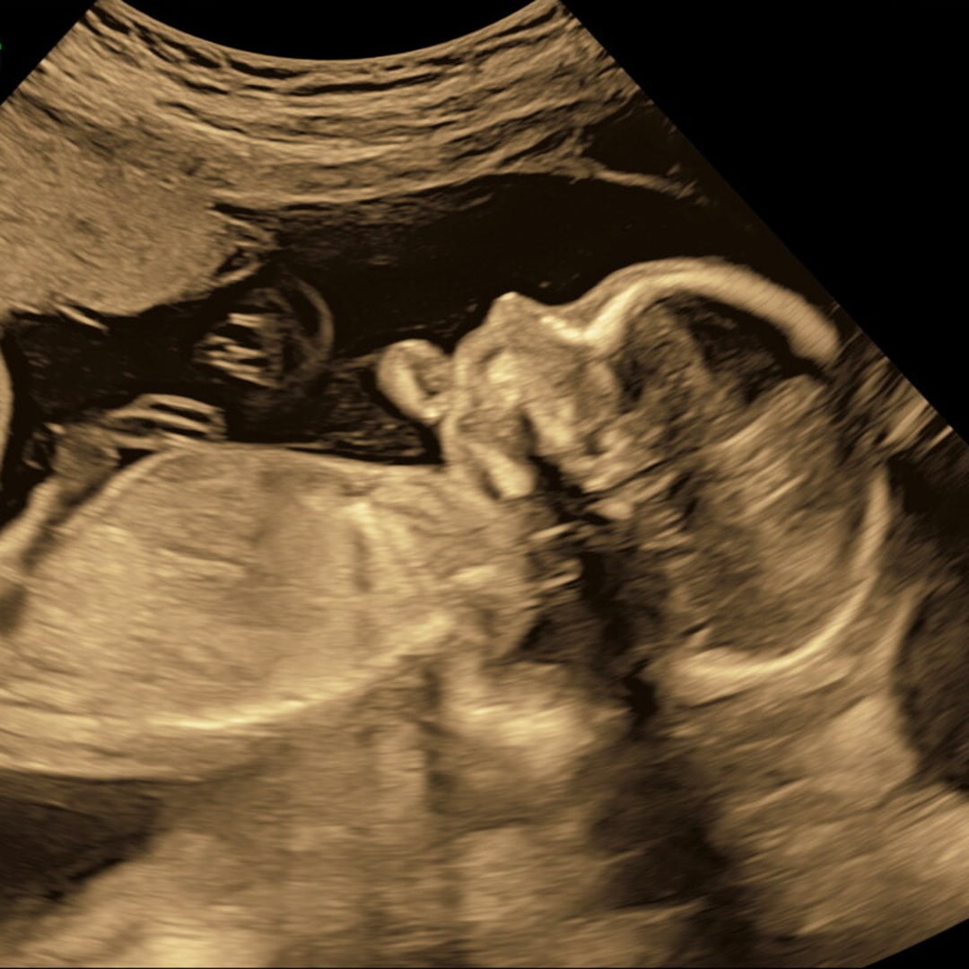 Photo shared by Tyffany for their Babylist baby registry.