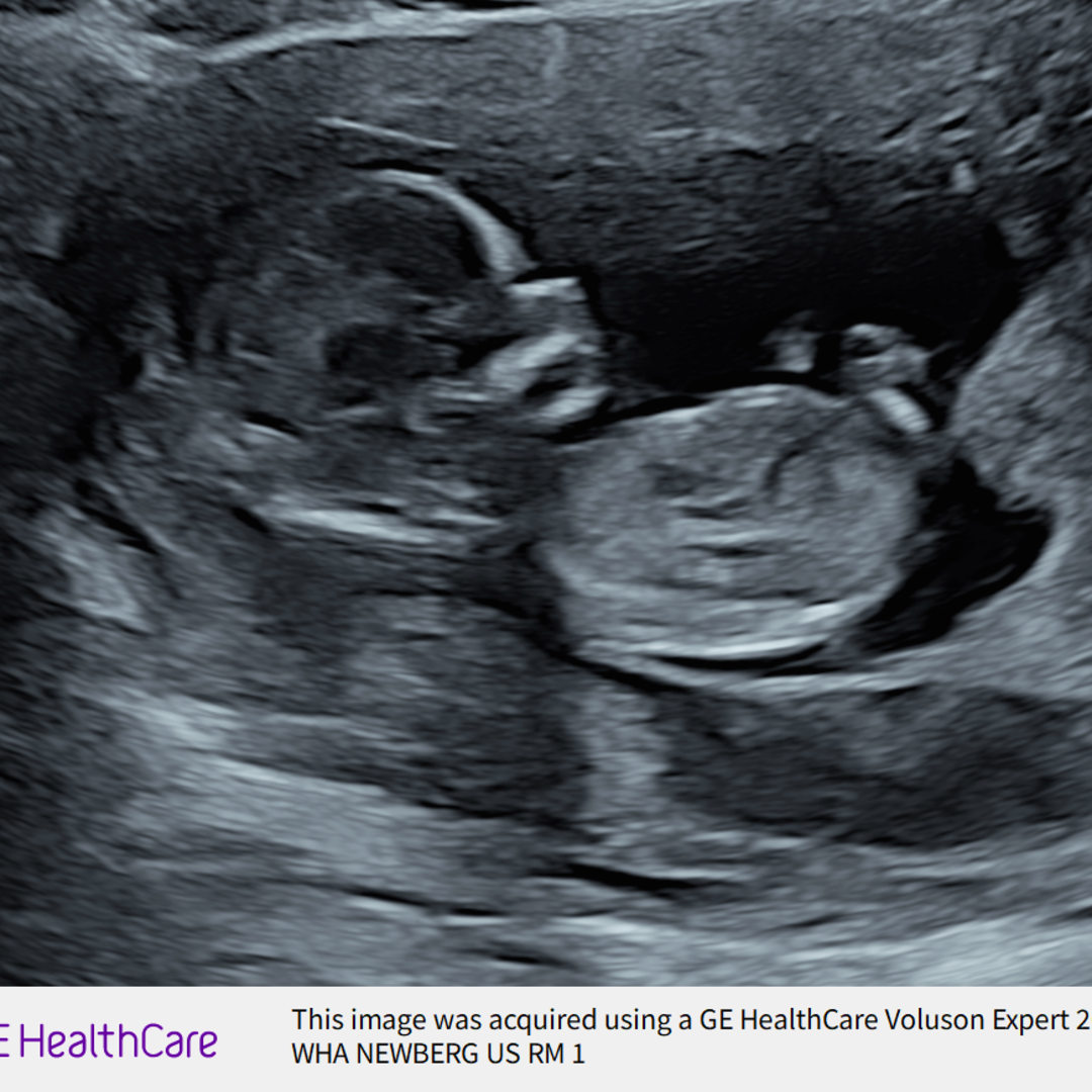 Photo shared by Jade for their Babylist baby registry.