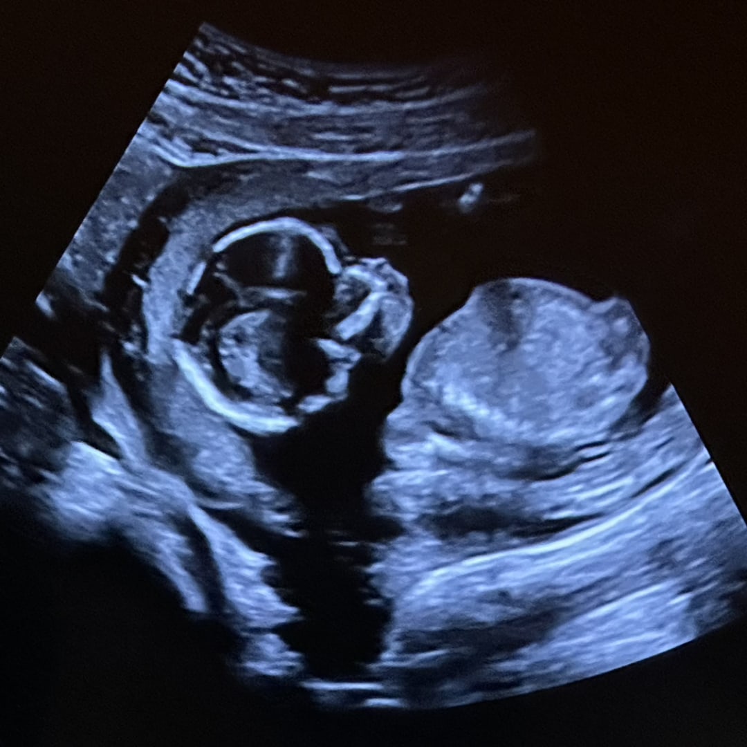 Photo shared by Molly for their Babylist baby registry.