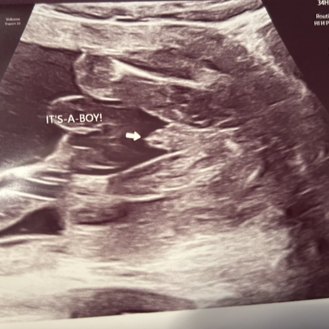 Photo shared by Chyanne for their Babylist baby registry.