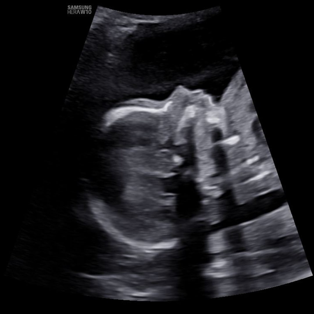 Photo shared by Addison for their Babylist baby registry.