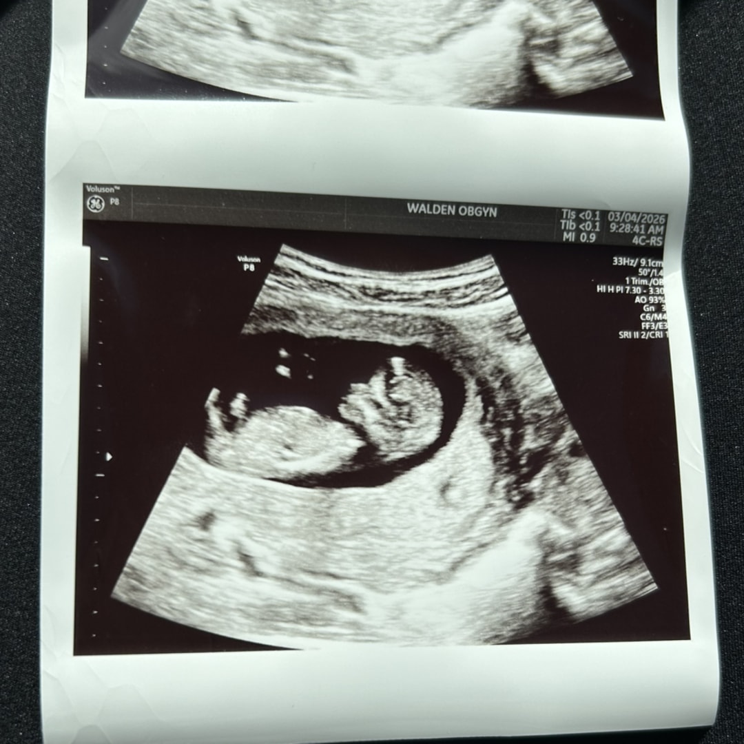 Photo shared by Brooke for their Babylist baby registry.