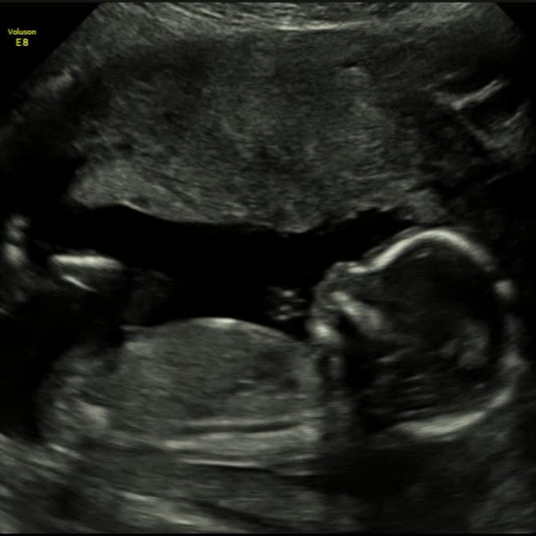 Photo shared by Meelah for their Babylist baby registry.