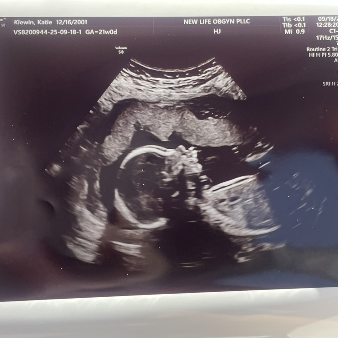 Photo shared by Katie for their Babylist baby registry.